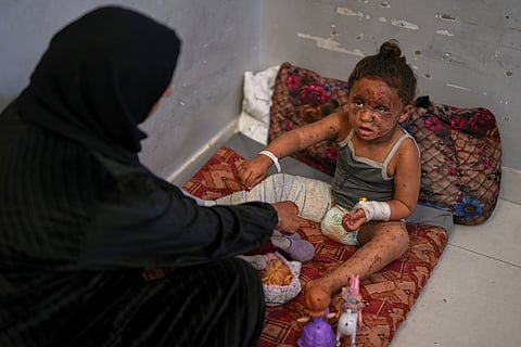 Raika Abu Sahloul, 40, cares for her 4-year-old niece, Layan, as she sits despondently among her dolls at Nasser hospital with second-degree burns on her face, foot, and stomach, caused a week earlier during an Israeli army strike on her home in Khan Younis that killed her pregnant mother and two siblings and buried her under the rubble, in Khan Younis, Gaza Strip, Sunday, May 4, 2025.