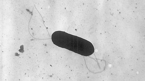 FILE - This 2002 electron microscope image made available by the Centers for Disease Control and Prevention shows a Listeria monocytogenes bacterium.