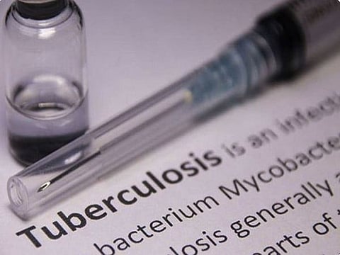 The treatment period for patients with drug-sensitive TB is nearly five months, whereas for those with drug-resistant TB could take up to two years.