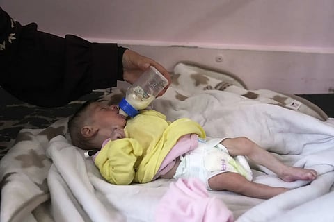 Naja Al-Najjar feeds her 5-month-old baby, Yousef, who suffers from malnutrition, at a clinic in Nasser hospital, Khan Younis, Gaza, Wednesday, May 21, 2025
