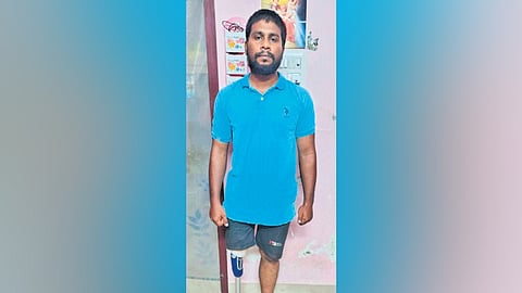 TN government provided him a prosthetic leg having hydraulic knee joint made by a German firm based in Tiruchy. 