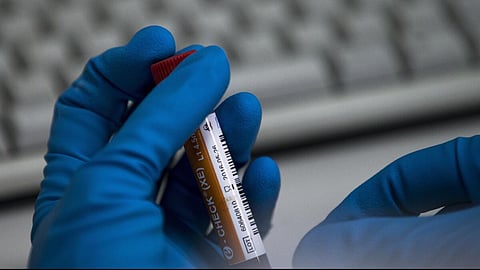 Mangaluru colleges begin drug tests on students, focus on counselling over punishment