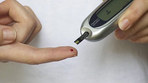 Representational image