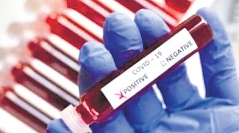 Image used for representational purposes only.