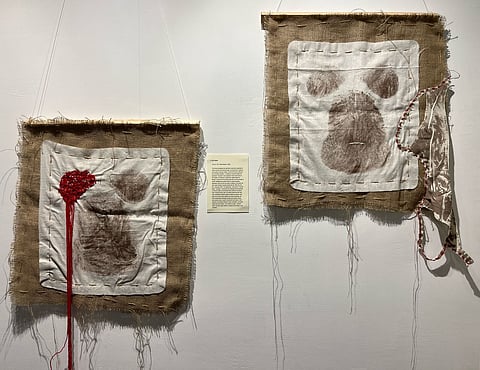 Confronting colourism and casteism 