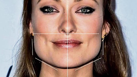 Unravelling the mystery of masseter botox