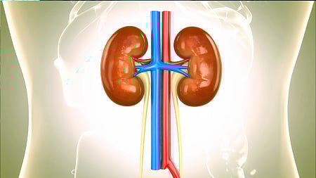 CAPD fluid is a sterile solution containing dextrose that is used in the dialysis procedure to remove waste and excess fluid from the body when kidneys fail.