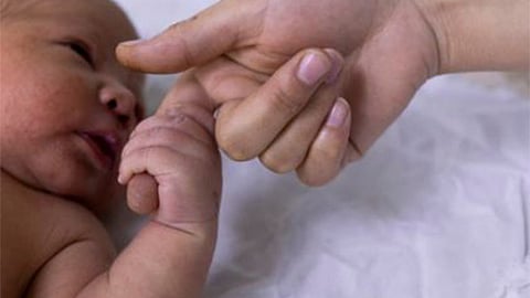 Representative Image