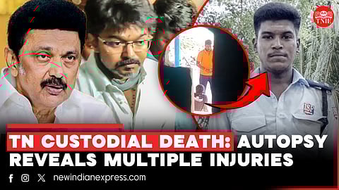 TN custodial death: Postmortem report reveals 44 external and internal injuries on victim’s body