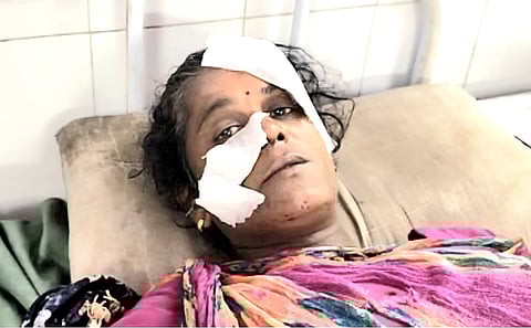 Kushala Devi sustained severe claw injuries to her nose and forehead and was rushed to Agastyamuni Hospital in critical condition.