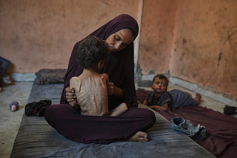 Naima Abu Ful poses for a photo with her 2-year-old malnourished child, Yazan, at their home in the Shati refugee camp in Gaza City, Wednesday, July 23, 2025.