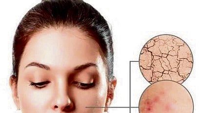 Photo for representation