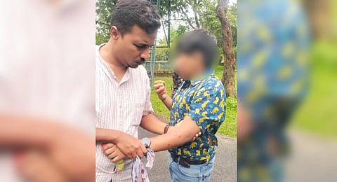 Injury marks on the boy’s arm.