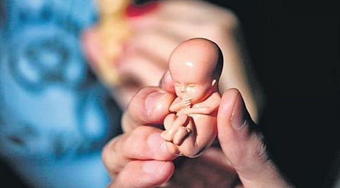 Image used for representative purposes only.