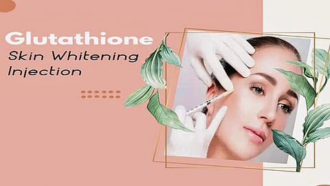 White is the Colour of Choice