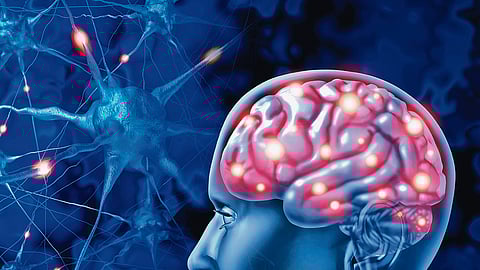 Illustration for representation