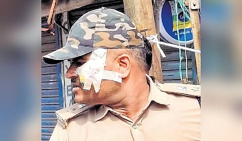 The injured DCP Khilari Rishikesh Dnyandeo
