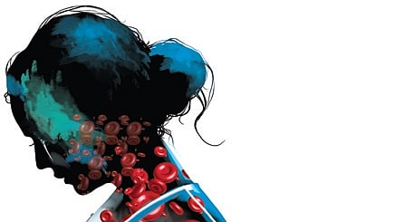 The initiative is projected to benefit more than 2,200 haemophilia patients currently registered with the department.