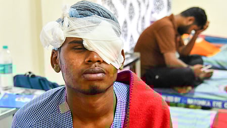 AIIMS Delhi reported 190 carbide gun-based eye injuries during Diwali