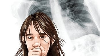 Image used for representative purpose.