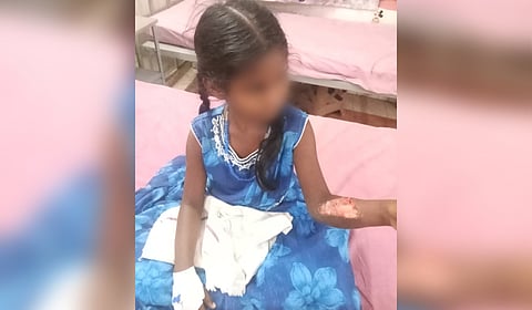 Hashini was admitted to hospital with a hand injury.