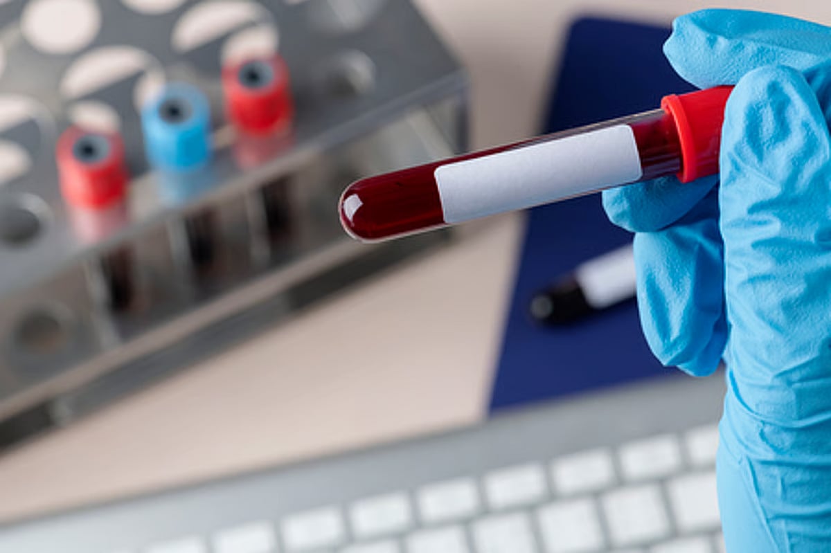 Need to further reduce risk of HIV transmission through blood transfusion in India: Experts Need to further reduce risk of HIV transmission through blood transfusion in India: Experts
