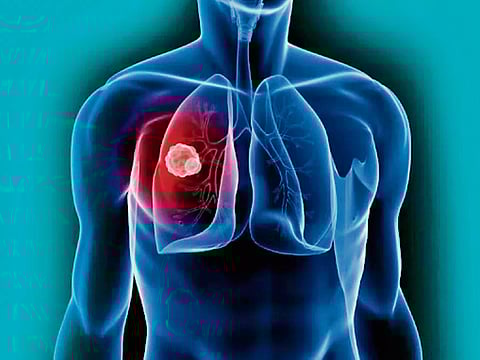 Is hygiene harming women's lungs?