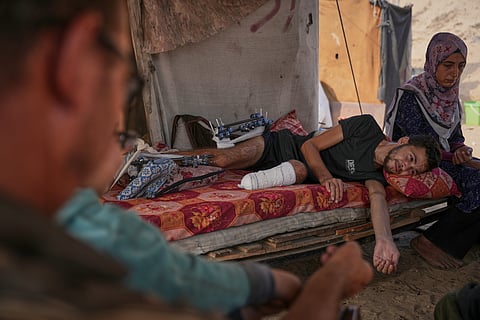 Yassin Marouf, 23, who lost his left foot and suffered a severe injury to his right leg after being hit by Israeli shelling in May, lies in a tent surrounded by his family in Zawaida, central Gaza, Thursday, Nov. 6, 2025. 