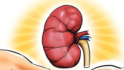 Representative image