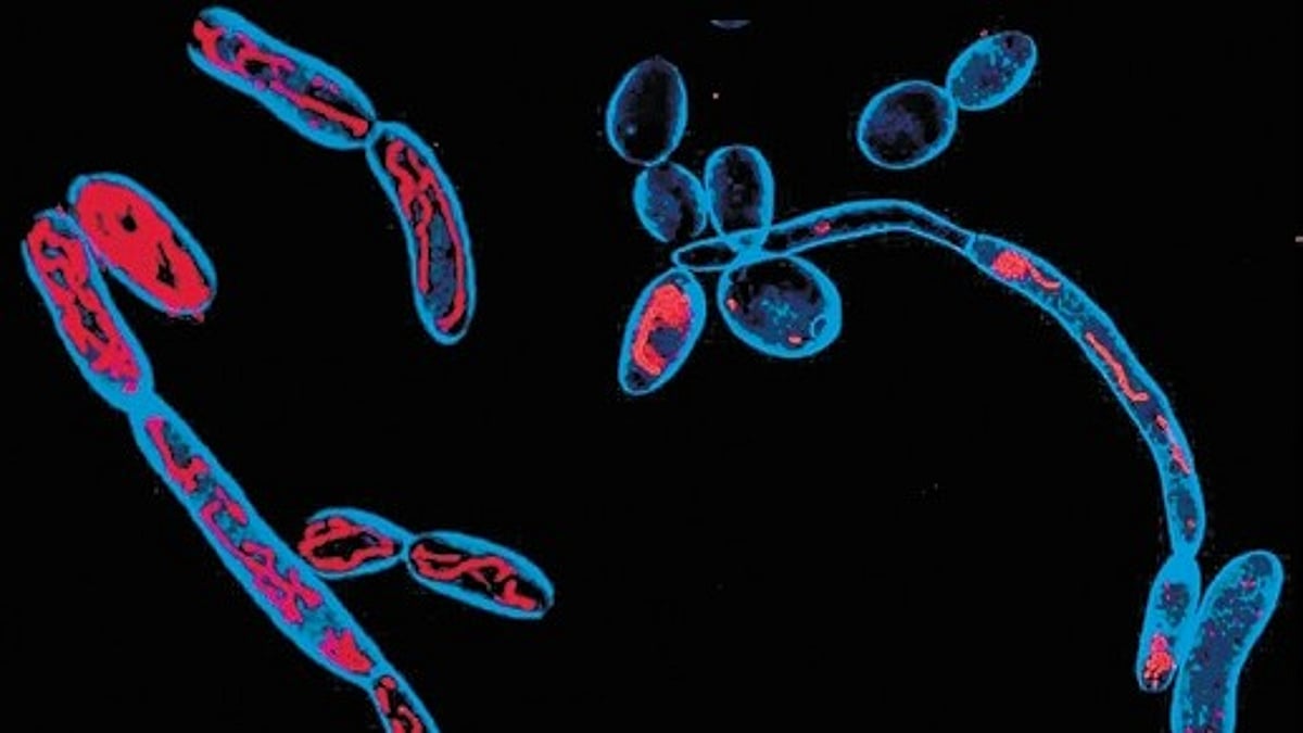 Scientists find way to tame fungi's superpower by targeting their sweet tooth