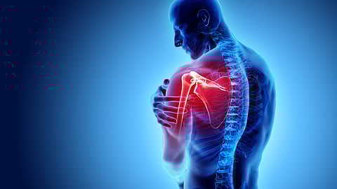 Can a fracture lead to arthritis later in life?