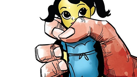 Reperesentative image