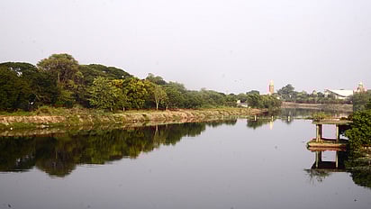 Representative image