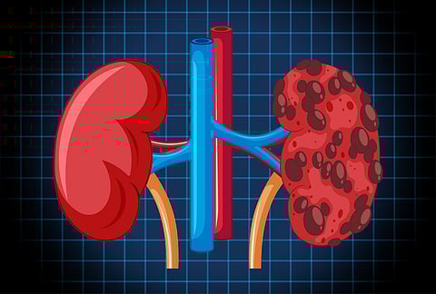 Kidney care: Why early detection matters