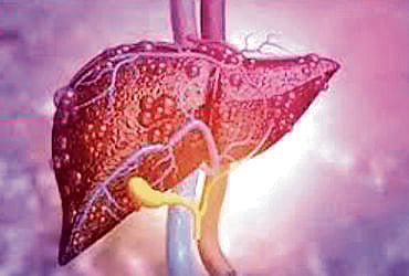 The Liver Fattening Sleep Crisis