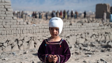 An injured Afghan girl stands near damaged houses at the site of an overnight Pakistan airstrike at a residential area in Pol-e-Charkhi on the outskirts of Kabul on March 13, 2026.