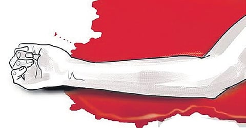 After killing the victim, the accused severed the legs, packed the body in a bag and dumped it, while the limbs were disposed of separately.