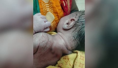 The baby, due to the severity of his injuries, was shifted to the special newborn care unit for treatment.