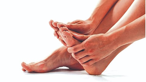 Beyond sweat: The hidden impact of Hyperhidrosis