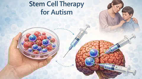 Stem cell therapy for autism