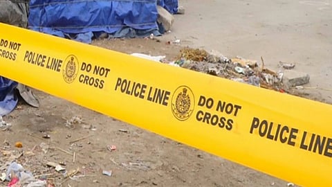 Representative image