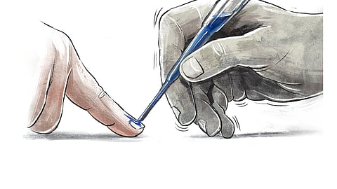 Representative image