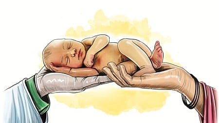 Representative Image