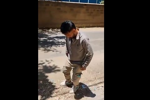 Man in viral video seen disoriented was under medication and alcohol, not xylazine