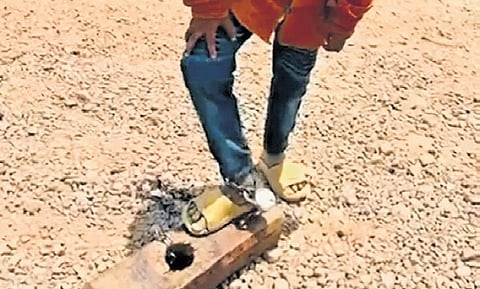 The visuals of the boy with his chained leg went viral on social media, triggering widespread condemnation from locals.