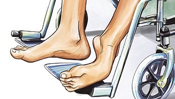 Representative image