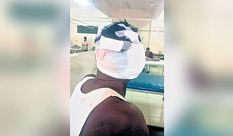 M Balakrishnan, who sustained serious injuries, is undergoing treatment at a private hospital.