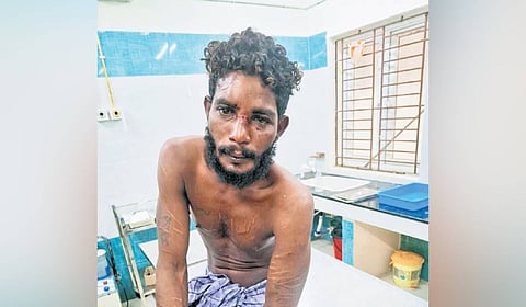 D Dayanas (27) of Anthoniarpuram in Jaffna